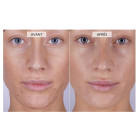 Светодиодная маска CurrentBody Skin Anti-Blemish LED Face Mask против несовершенств кожи
