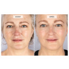 Набор CurrentBody Skin LED Light Therapy Face & Neck Kit для лица, шеи и зоны декольте 