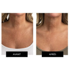 Набор CurrentBody Skin LED Light Therapy Face & Neck Kit для лица, шеи и зоны декольте 
