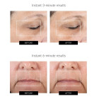 Микротоковый массажер NuFace FIX Line Smoothing для лица