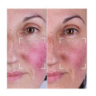 Набор CurrentBody Skin LED Light Therapy Face & Neck Kit: Series 2 для лица, шеи и зоны декольте