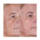 Набор CurrentBody Skin LED Light Therapy Face & Neck Kit: Series 2 для лица, шеи и зоны декольте