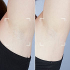 Лазерный эпилятор CurrentBody Skin Laser Hair Removal Device