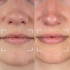 Светодиодный прибор для губ CurrentBody Skin LED Lip Perfector 