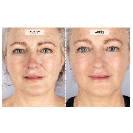 Набор CurrentBody Skin LED Light Therapy Face & Neck Kit для лица, шеи и зоны декольте 