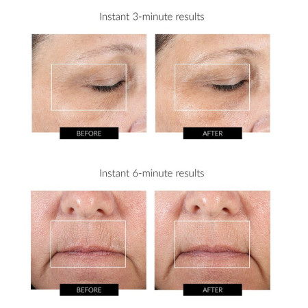 Микротоковый массажер NuFace FIX Line Smoothing для лица