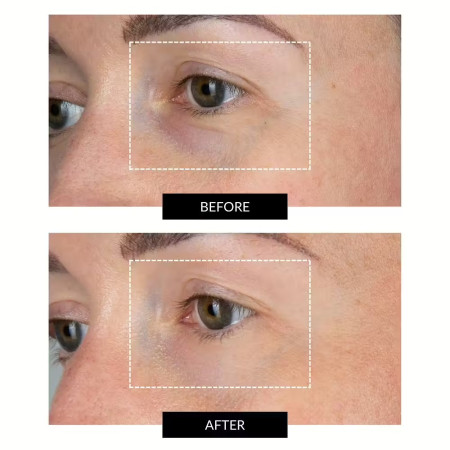 Светодиодная маска CurrentBody Skin LED Eye Perfector для кожи вокруг глаз