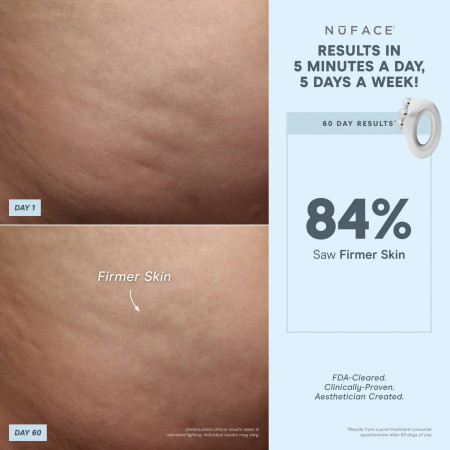 Микротоковое устройство NuFace Nubody Skin Toning Device + аква-гель NuFACE Hydrating Aqua Gel