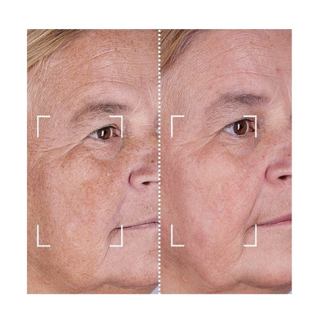 Набор CurrentBody Skin LED Light Therapy Face & Neck Kit: Series 2 для лица, шеи и зоны декольте