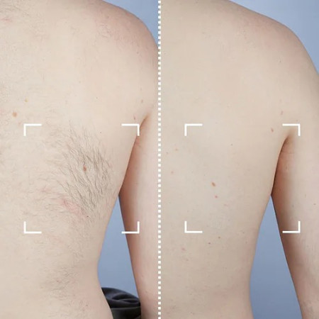 Лазерный эпилятор CurrentBody Skin Laser Hair Removal Device