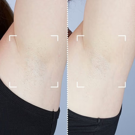 Лазерный эпилятор CurrentBody Skin Laser Hair Removal Device