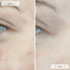 Світлодіодна маска Omnilux Contour Face Anti-Ageing Led Light Therapy антивікова