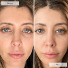 Світлодіодна маска Omnilux Contour Face Anti-Ageing Led Light Therapy антивікова