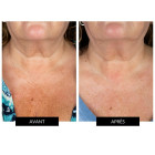 Світлодіодна маска CurrentBody Skin LED Neck and Dec Perfector для шиї та декольте
