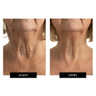 Світлодіодна маска CurrentBody Skin LED Neck and Dec Perfector для шиї та декольте