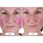 Світлодіодна маска CurrentBody Skin LED Light Therapy Face Mask: Series 2 нового покоління
