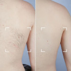 Лазерний епілятор CurrentBody Skin Laser Hair Removal Device