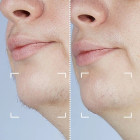 Лазерний епілятор CurrentBody Skin Laser Hair Removal Device