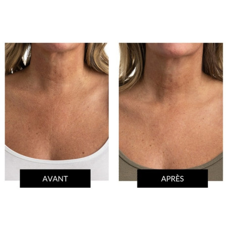 Набір CurrentBody Skin LED Light Therapy Face & Neck Kit для обличчя, шиї та зони декольте