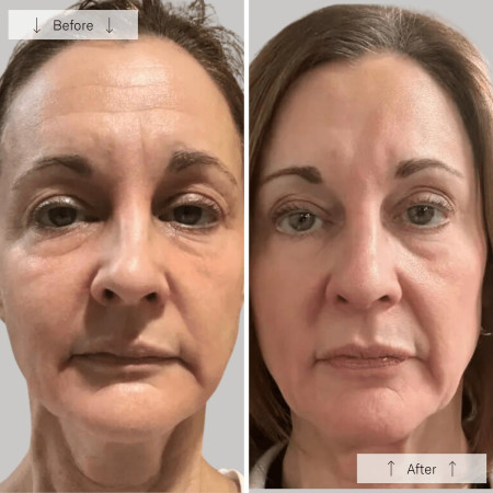 Світлодіодна маска Omnilux Contour Face Anti-Ageing Led Light Therapy антивікова