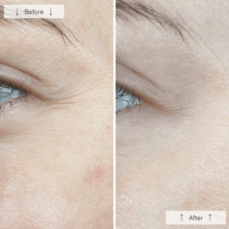 Світлодіодна маска Omnilux Contour Face Anti-Ageing Led Light Therapy антивікова