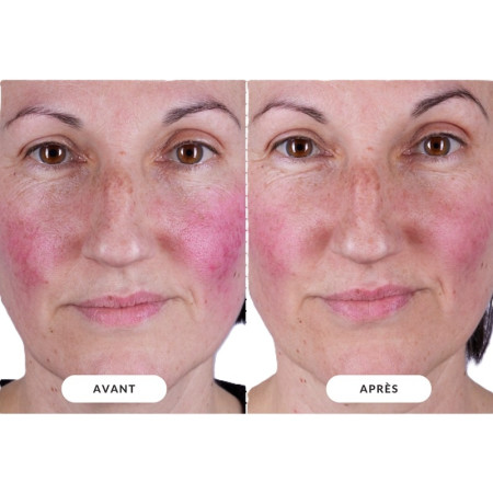 Світлодіодна маска CurrentBody Skin LED Light Therapy Face Mask: Series 2 нового покоління